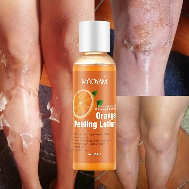 Orange Peeling Mask Lightening Body Face Lotion Strong Whitening Peeling Lotion 100ml