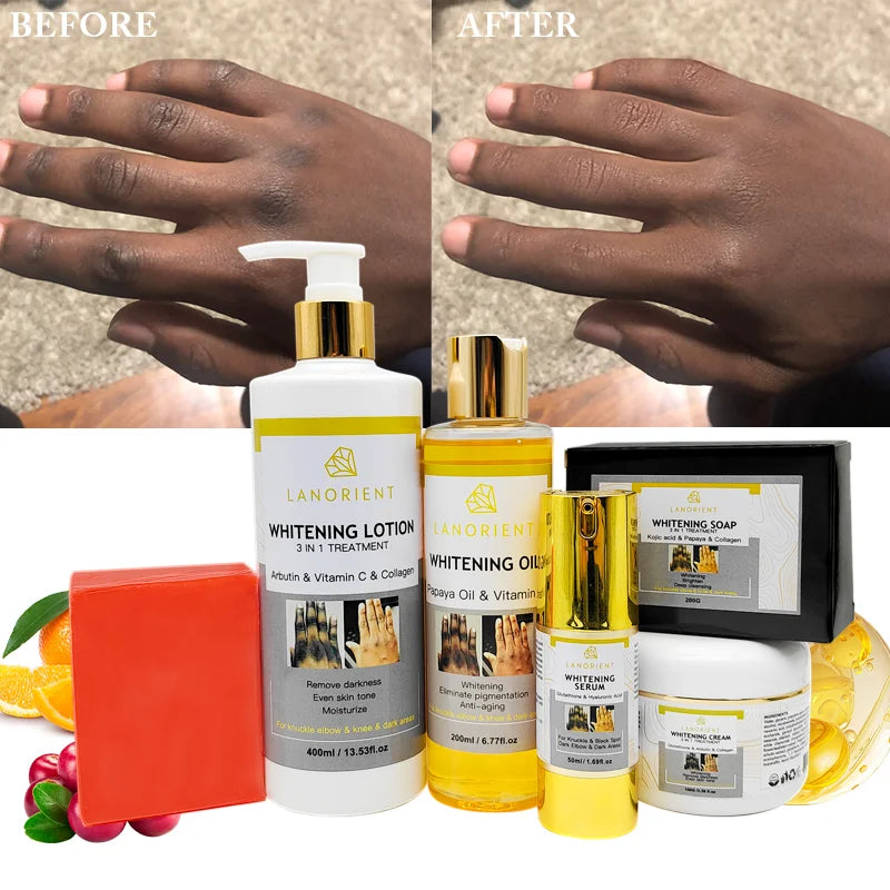 Knuckle Whitening Skin Care 5pc Set 