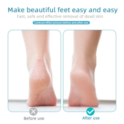 Usb-fotvårdsverktyg Död hud förhårdnadsborttagare Fotslipmaskin Pedikyrverktyg Fotvårdsslipmaskin