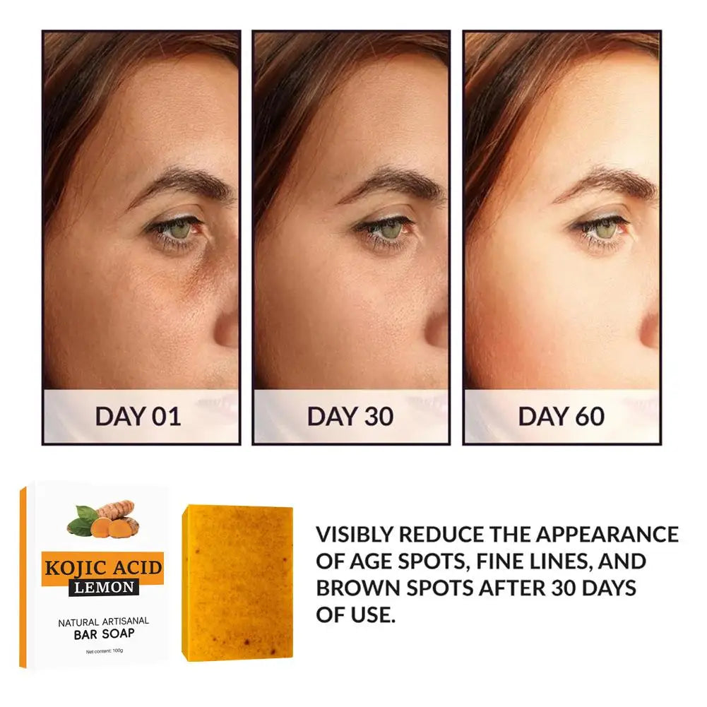 5 PCS Turmeric Lemon Kojic Soap