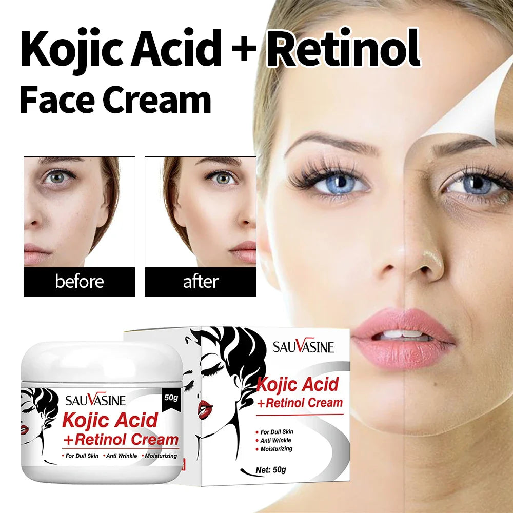 50g Kojic Acid Face Cream + 30ml Facial Serum Fade Dark Spots Brightening Skin Whitening Cream