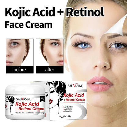 50g Kojic Acid Face Cream + 30ml Facial Serum Fade Dark Spots Brightening Skin Whitening Cream